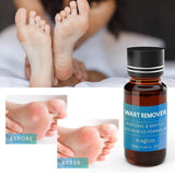 Evagloss Wart Remover Liquid - Maximum Strength- Painlessly Removes Common and Plantar Warts- BONUS Cotton Swabs