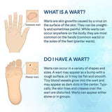 Evagloss Wart Remover Liquid - Maximum Strength- Painlessly Removes Common and Plantar Warts- BONUS Cotton Swabs